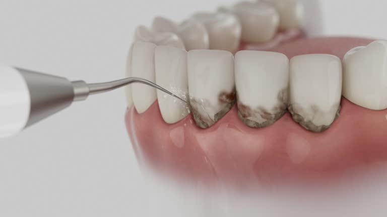 Trusted Root Canal Treatment service in Sheffield, AL - Dentist Open Now